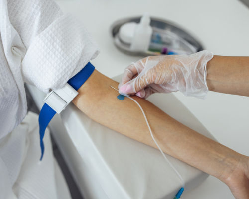 Perfusion